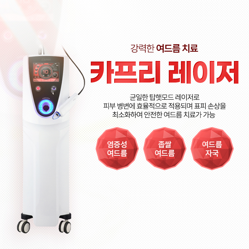 카프리 - 미사점